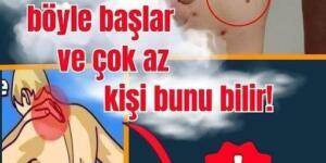 Bu belirtilere d!kkat! K-a’n ser ilk olarak böyle belirtiler veriyor.