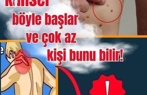 Bu belirtilere d!kkat! K-a’n ser ilk olarak böyle belirtiler veriyor.