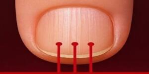 Akciğer K-a’n serinin Belirtilerini Öğrenin ve Önlemlerini Alın