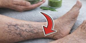 1 Yaprak ŞEKER HASTALIĞINI, YÜKSEK TANSİYONU yok eder