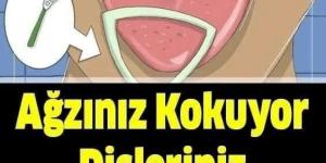 Ağız Kokusu vede Diş A’ğrısından Kurtulmanın Yolu Çok Kolay..