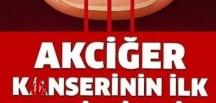 Akciğer K-a’n serinin Belirtilerini Öğrenin ve Önlemlerini Alın